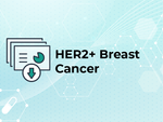 Advanced Approaches in Treating HER2-Positive Breast Cancer