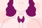 Understanding Hypothyroidism: A Complete Guide for Patients